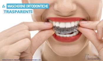 Ortodonzia invisibile mascherine ortodontiche trasparenti